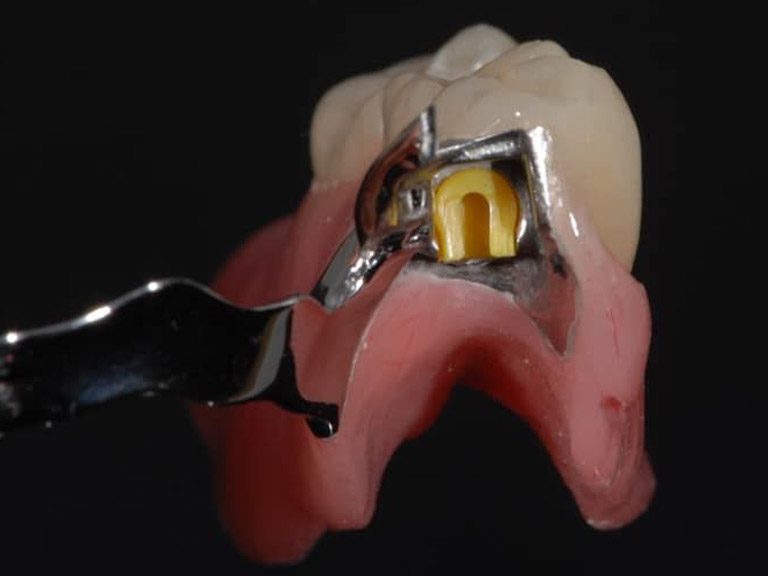 Bespoke Dentures Horwich Bolton Manchester Bespoke Dentures Horwich Bolton Manchester