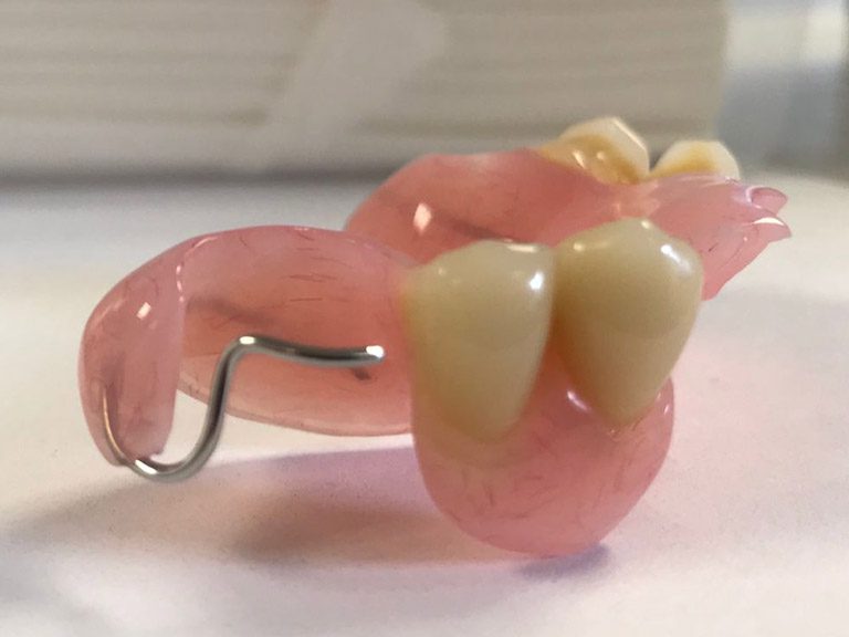 Partial Dentures Horwich Denture Clinic Bolton Lancashire Northwest Partial Dentures Horwich Denture Clinic Bolton Lancashire Northwest