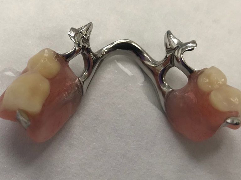 Partial Dentures Horwich Denture Clinic Bolton Lancashire Northwest Partial Dentures Horwich Denture Clinic Bolton Lancashire Northwest