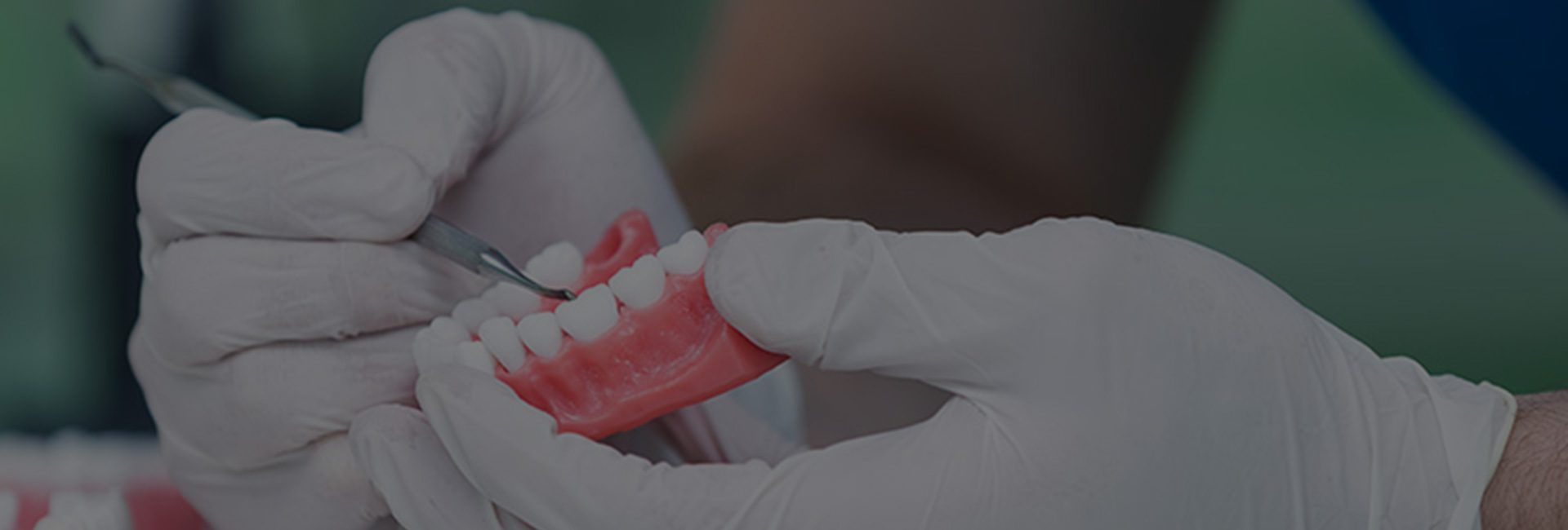 Repairs and Relines Horwich Denture Clinic Bolton Manchester Lancashire Northwest Repairs and Relines Horwich Denture Clinic Bolton Manchester Lancashire Northwest